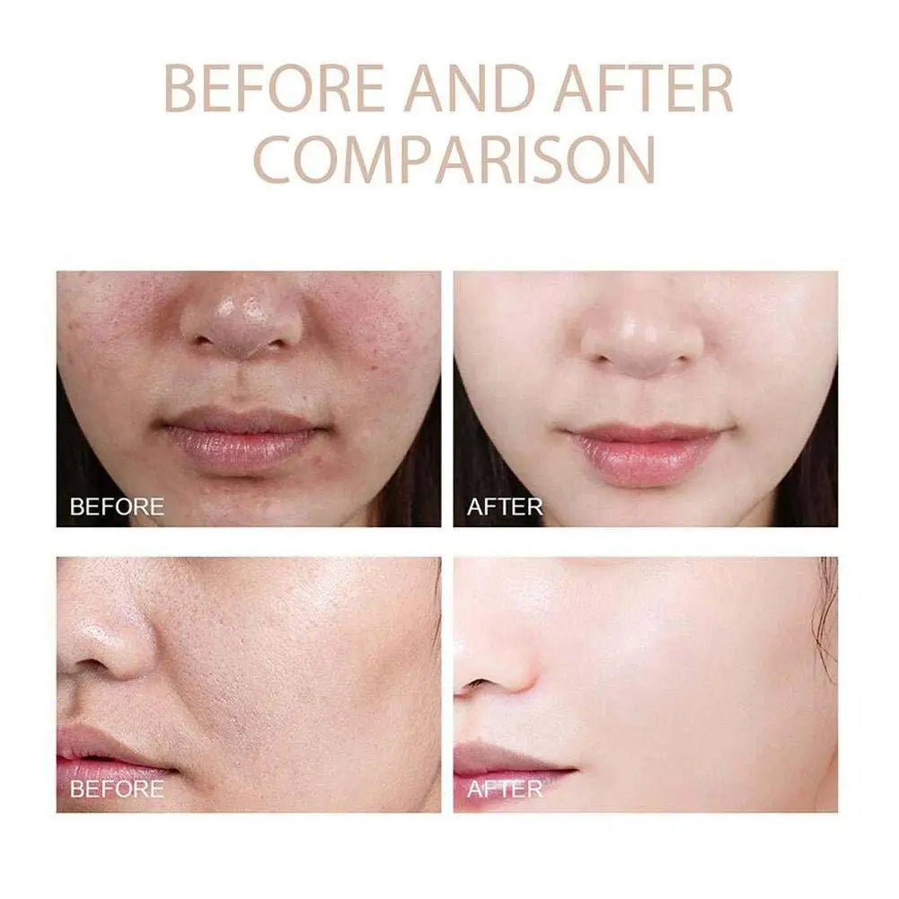 Facial anti oxidant water emulsion essence rice extract can repair damaged skin barrier and refresh skin care