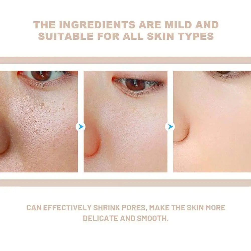 Facial anti oxidant water emulsion essence rice extract can repair damaged skin barrier and refresh skin care